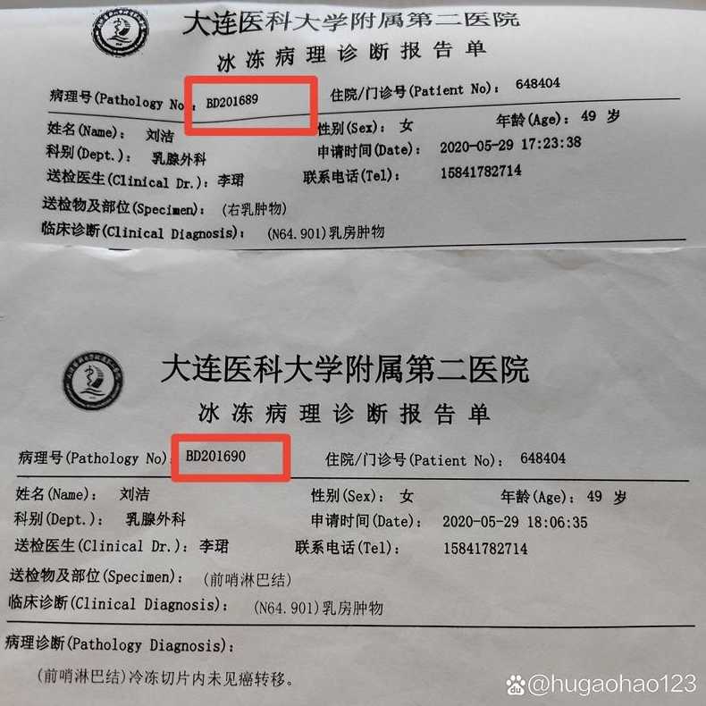 大连60例病例详情有20多名学生(大连60例病例详情有20多名学生感染)